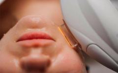 Смас-ліфтинг у місті Київ (Солом'янка і Дарниця) - Са-Ната Естетік